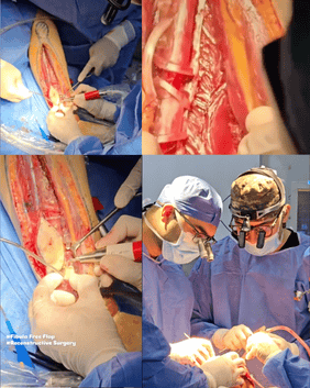 Operating room views of maxillofacial and neck surgery performed by Prof. Dr Ibrahim Elsharabasy and team